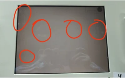 What Causes White Spots on LCD Screens? (Complete Explanation)