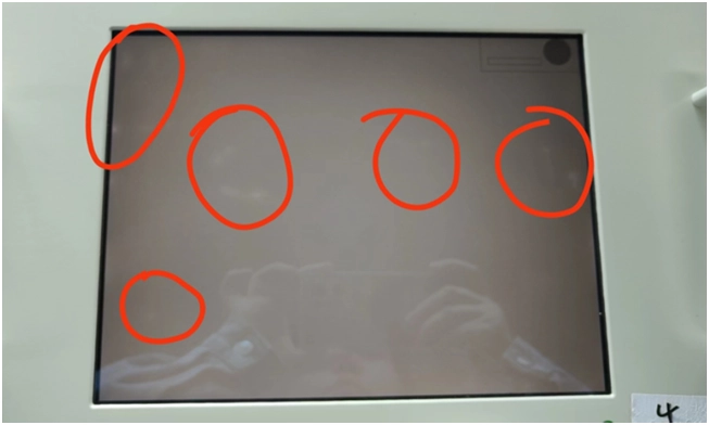 What Causes White Spots on LCD Screens? (Complete Explanation)