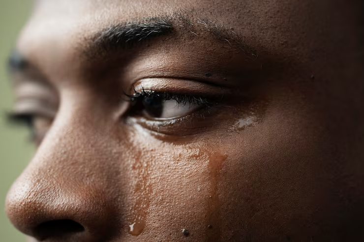 Why Do My Eyes Burn When I Cry?